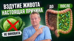 Вздутие живота и метеоризм: причины — дисбактериоз и как восстановить микрофлору за 2 месяца