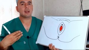 ҚИЗЛИК ПАРДАСИ БЎЛСА ХАМ ХОМИЛАДОР БЎЛИШИ МУМКИНМИ ? 18+