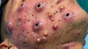 Успокаивающий уход за лицом для снятия стресса в спа-салоне: обретение внутреннего покоя #26612166