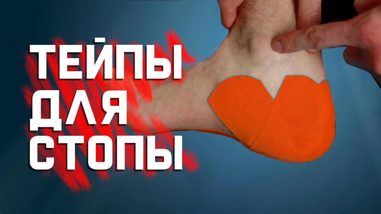 Как затейпировать плантарный фасциит (пяточную шпору) самому себе? смотреть онлайн