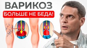 Варикоз на ногах и сосудистые звездочки уйдут навсегда! Самое лучшее действие от варикоза!