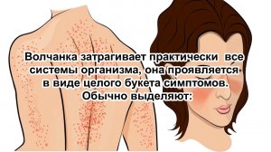 Волчанка и её связь с кишечником. Как выключить аутоиммунную реакцию?