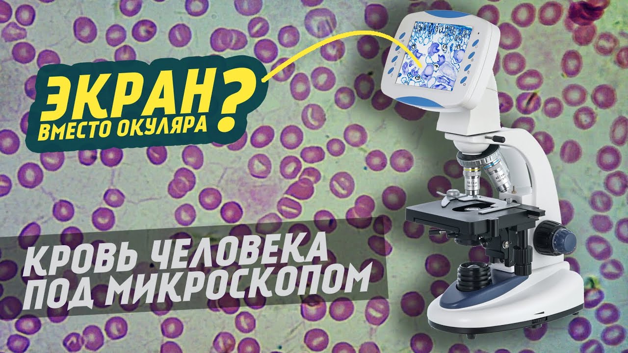 Цифровой Микроскоп Levenhuk DL LCD | Тест | Обзор смотреть онлайн
