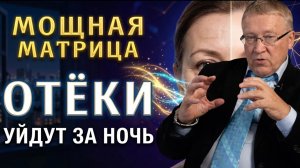 Мощная Матрица: Слив лишней воды и Очищение Лимфы ☀️ Мгновенная Легкость