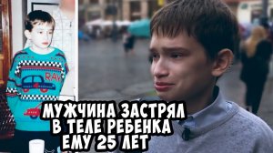 Этому «ребёнку»  25 лет!!! Мужчина застрял в теле подростка...