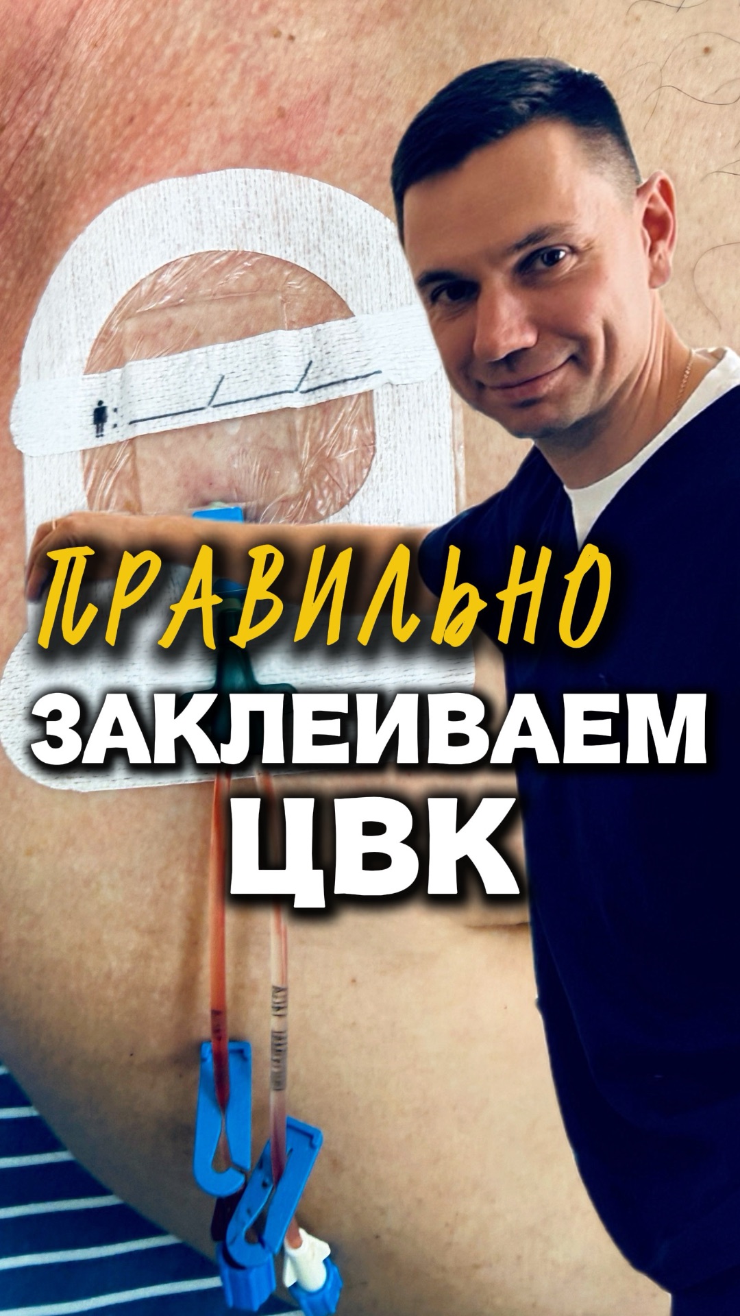 КАТЕТЕРИЗАЦИЯ СОСУДОВ