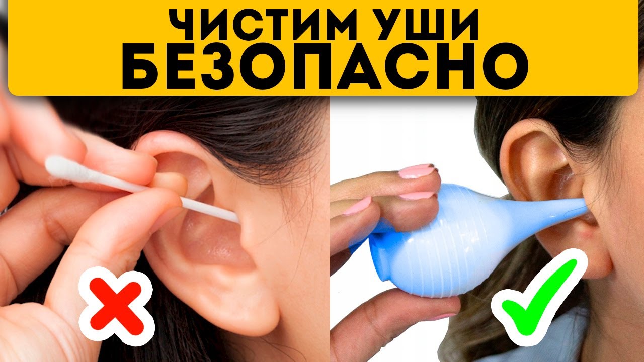 ЛОР: Умоляю, забудьте вы об этих палочках! Чистить уши нужно… смотреть онлайн