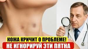 Почему появляются тёмные пятна на коже