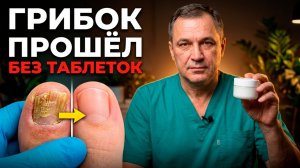 99% людей НЕ ЗНАЮТ: как вылечить грибок ногтей быстро и навсегда?
