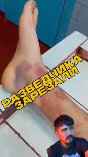 ОСТОРОЖНО ЦИПСО❗️❗️❗️