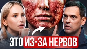Ваши нервы уничтожают лицо. Главная причина морщин и акне, о которой молчат / Подкаст