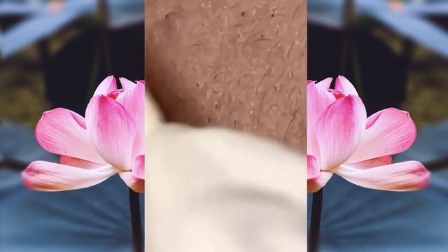 ВЫДАВЛИВАНИЕ ПРЫЩЕЙ и ЧЕРНЫХ ТОЧЕК! p23 смотреть онлайн