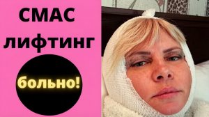 Блефаропластика и СМАС лифтинг. Личный опыт