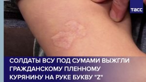 Солдаты ВСУ под Сумами выжгли гражданскому пленному курянину на руке букву «Z»