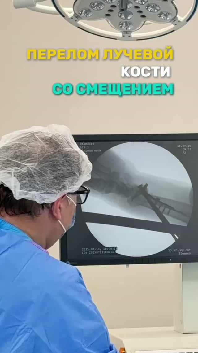 ⚡️Перелом лучевой кости со смещением. ЛД Медицина