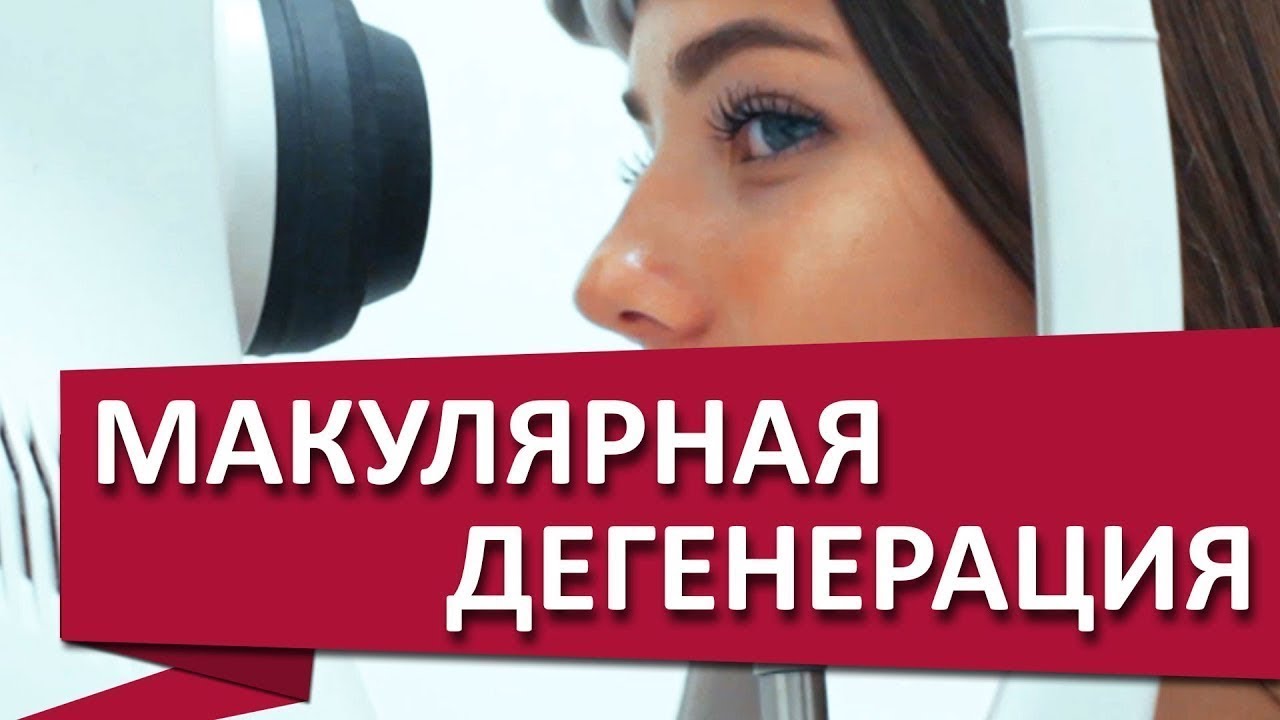 Лечение сетчатки. 👓 Возрастная макулярная дегенерация сетчатки глаза, лечение. МДЦ ОЛИМП смотреть онлайн