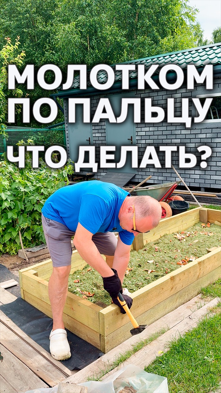 ЕСЛИ УДАРИЛИ ПО ПАЛЬЦУ МОЛОТКОМ 🔨 ЧТО ДЕЛАТЬ? #СОВЕТ