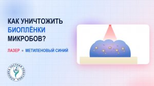 Как разрушить биопленки микробов? Лазер и метиленовый синий!