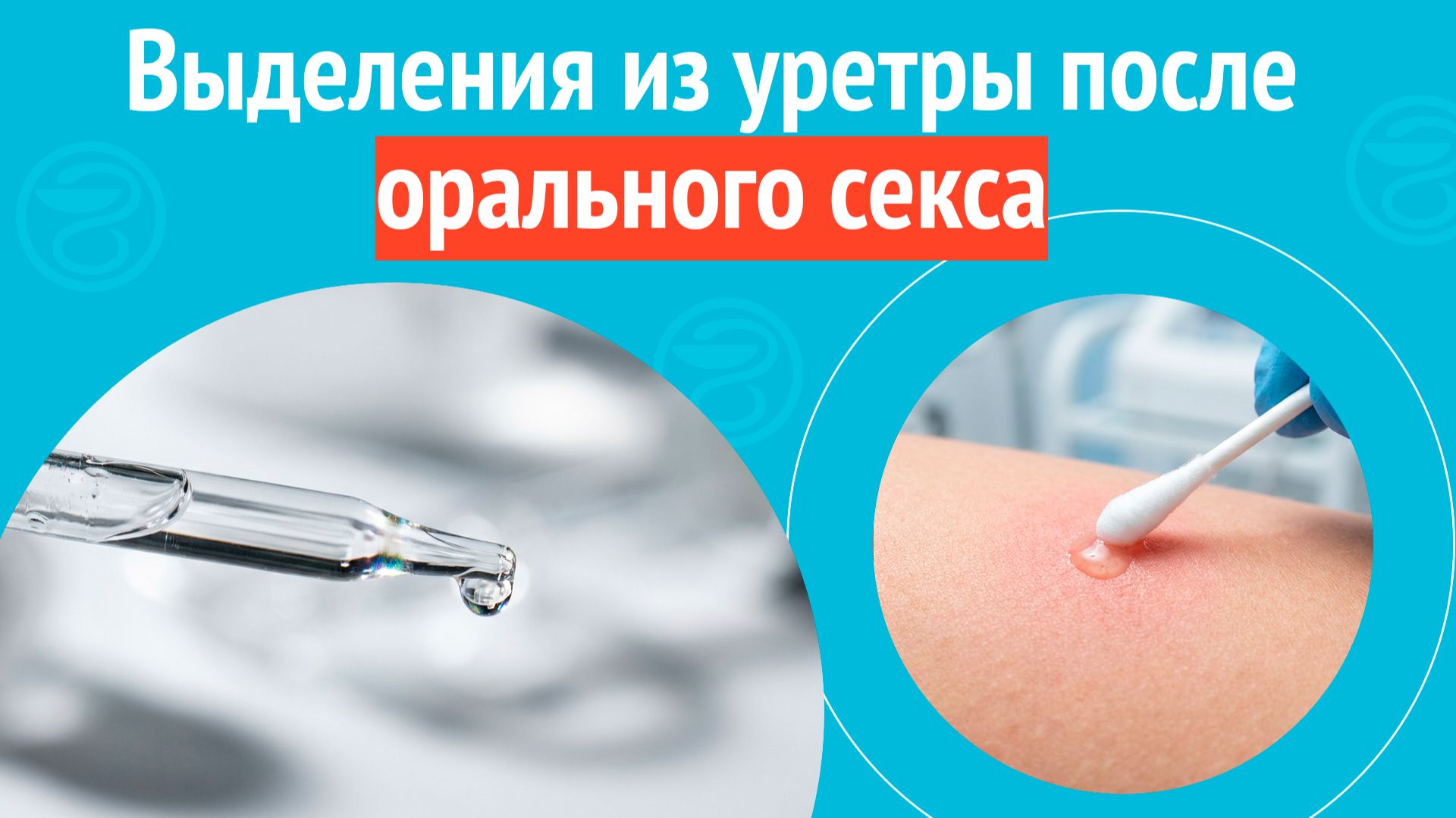 ➡️ Выделения из уретры после орального секса. Клинический случай №1696 смотреть онлайн