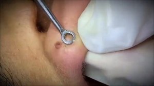 Расслабляющее удаление черных точек и глубокая очистка пор (ASMR)
