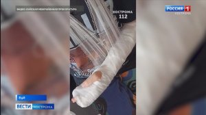 18-летняя буевлянка получила тяжелые травмы на детской площадке