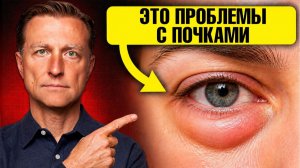 Проблемы с почками можно заметить ПО ГЛАЗАМ
