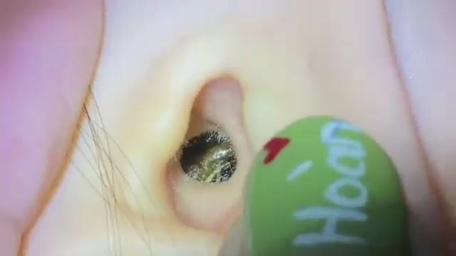 УХО СЕРА КРУПНО! смотреть онлайн