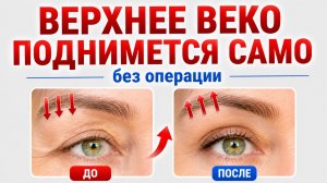 КАК ПОДТЯНУТЬ верхнее ВЕКО без операции за 5 минут в день