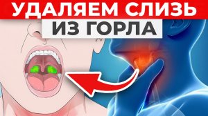 Вот как быстро избавиться от слизи в горле в домашних условиях!