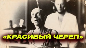 «ЕГО ЧЕРЕП МНЕ ПРИГОДИТСЯ». — безумный заказ профессора  (Коллекция Августа Хирта)