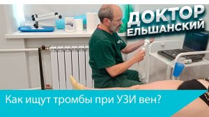 Как ищут тромбы при УЗИ вен?