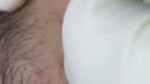 ВЫДАВЛИВАЕТ ПРЫЩИ И УГРИ. СОЧНОЕ РЕЛАКС ВИДЕО