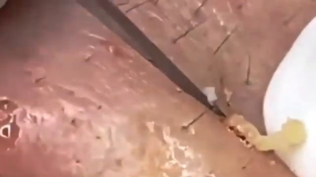 ГЛУБОКАЯ ЧИСТКА ЛИЦА ОТ ЧЁРНЫХ ТОЧЕК — ПОСМОТРИ ДО КОНЦА смотреть онлайн