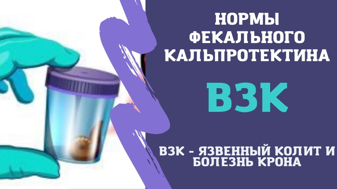 Нормы фекального кальпротектина при неспецифическом язвенном колите и болезни крона (ВЗК, НЯК, БК) смотреть онлайн
