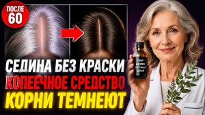 Седина уходит без краски? 1 копеечное средство — и корни темнеют за 3 недели