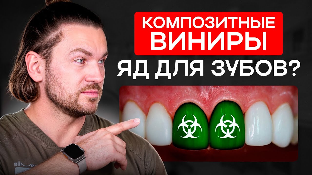 Композитные ВИНИРЫ — почему это ОПАСНО? / Ошибка в выборе виниров и серьезные последствия смотреть онлайн