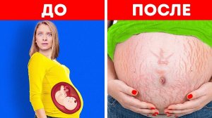 21+ ЗАБАВНЫЙ МОМЕНТ ИЗ ЖИЗНИ БЕРЕМЕННЫХ от канала Бери и Делай КЛАССНО