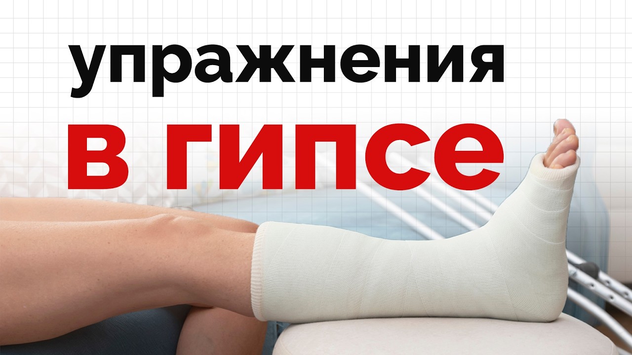 Укрепляйте голеностоп даже в гипсе - быстрая реабилитация в ваших руках смотреть онлайн