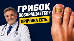 Грибок ногтей после 50: почему он возвращается и какие ошибки мешают лечению