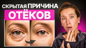 Отеки и мешки под глазами: СКРЫТАЯ причина и 1 точка, которая убирает ВСЕ