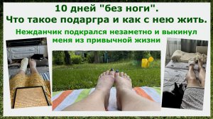 10 дней «без ноги». Что такое подагра и как с нею жить. Нежданчик подкрался незаметно