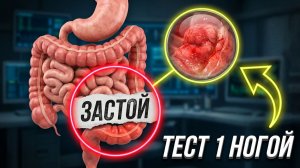Тест одной ногой покажет, где застой и воспаление в кишечнике