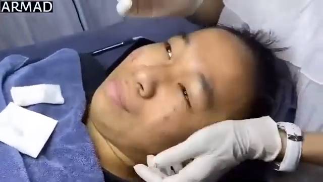 ПРЫЩИ И ЧЕРНЫЕ ТОЧКИ КРУПНО КОРЕЯ 2 смотреть онлайн