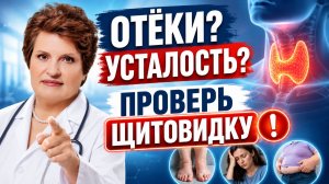 Лишний вес, отёки и усталость? Проверьте щитовидку! Скрытый гипотиреоз