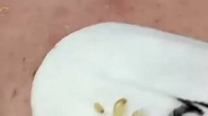 Relaxing Blemish Care and Deep Pore Cleansing #34623