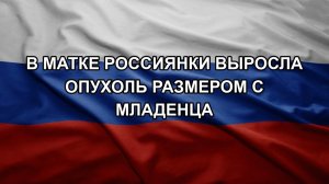 В матке россиянки выросла опухоль размером с младенца