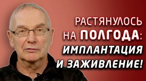 Пациенту устанавливали импланты, циркониевый мост и коронки, и кандулор на телескопах с имплантами!