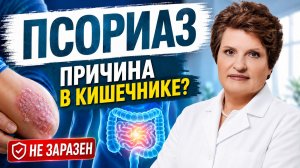 Псориаз — это не только кожа! Главная причина может быть в кишечнике