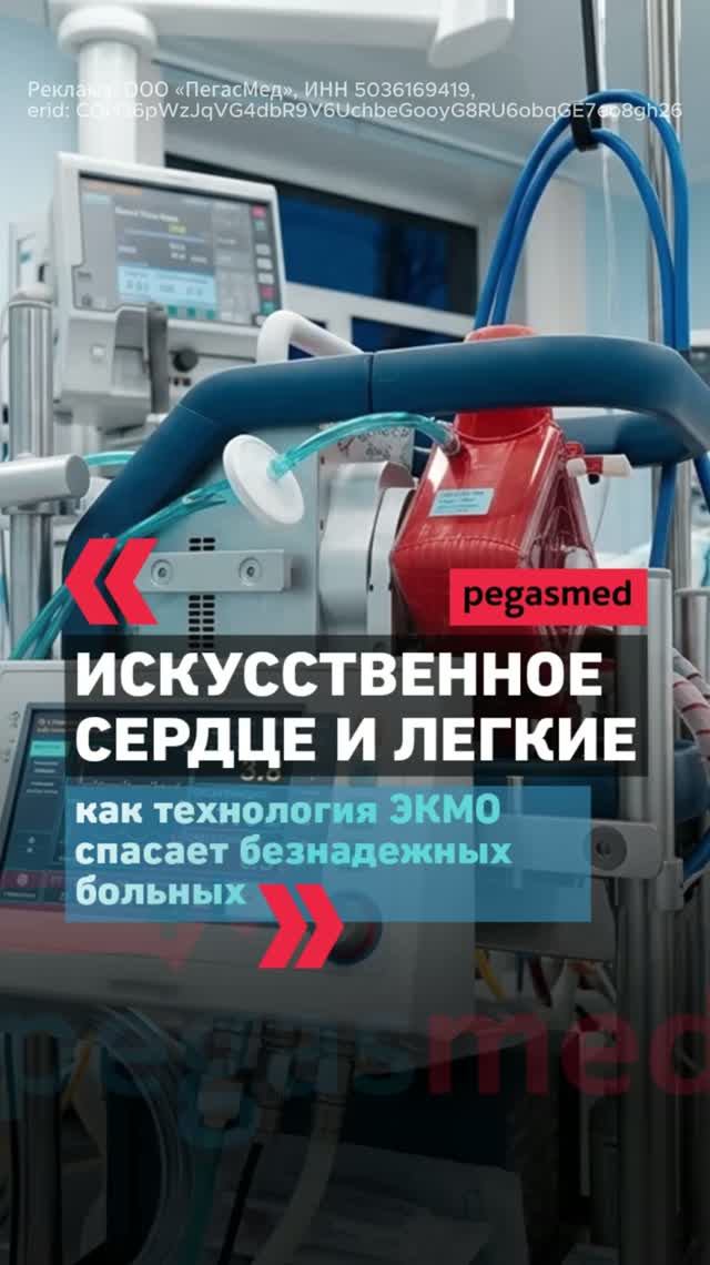 Искусственное сердце и легкие: как технология ЭКМО спасает безнадежных больных