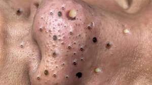 Achieve Inner Peace with These Facial Cleansing Meth�